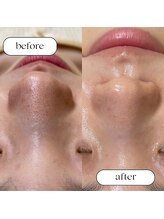 トータルビューティーサロンリア(Li'a)/ビフォー＆アフター