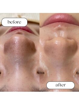 トータルビューティーサロンリア(Li'a)/ビフォー＆アフター