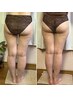 気になるお肉を撃退！1部位集中削ぎコース　60分　￥10000→￥7500