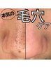 【再来1ヶ月以内】毛穴エクストラクション＋セラミド導入《17900→15900》
