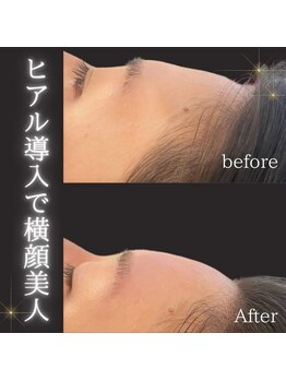 ソナ 大和西大寺院(SONA)/