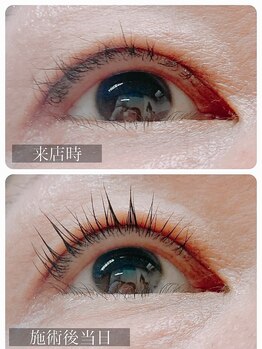 セレンディピティ(Serendipity)/マイラミネーション