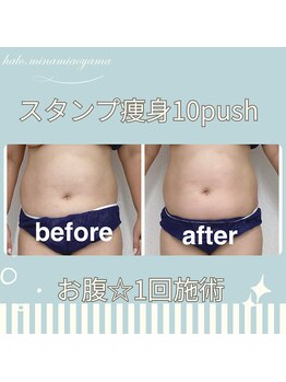 ハロ 南青山(HALO)/スタンプ痩身10push