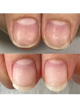 ミル(mill)/自爪育成