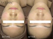 ヴェリス 福岡店(Velisse)/