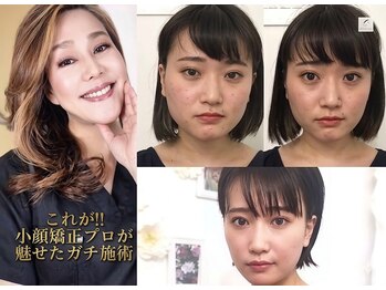 サロンチオリ 烏丸(Salon Chiori)の写真/【40代からの切らない小顔】糸リフト前に！独自の口内筋ケアでエラ張り・顔の伸びを徹底たるみ改善へ