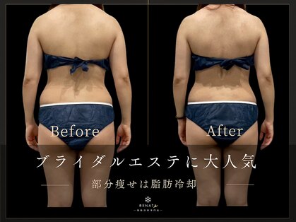 レナータ 渋谷店(RENATA)の写真