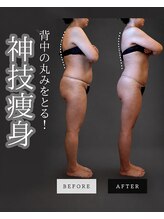ボーテヌール(Beaute Nheur)