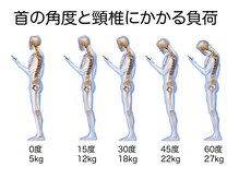 フー(fuu)/スマホ首になっていませんか？