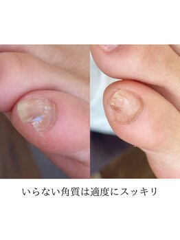 レイ(Rei)/ビフォーアフター!