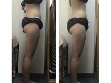 ミマインズ 倉敷本店(Me Mines)/痩せて幸せになりたい！