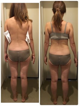 ブルーコーラル エム(BLUE CORAL M)/背面リンパマッサージ