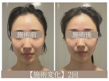 ドクターボディ 恵比寿店(Dr.Body)/【リフトアップ/長さ 20代】