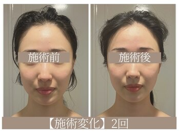 ドクターボディ 恵比寿店(Dr.Body)/【リフトアップ/長さ 20代】