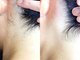 アース コアフュールボーテ 新潟中野山店 (EARTH Coiffure beaute')の写真/スピーディー!脱毛メニュー導入★忘れがちな産毛～気になる太い毛まで徹底脱毛!キメの整った美肌に◎