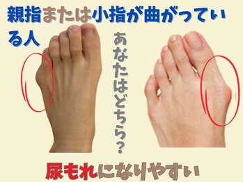 ニコ(niko)/足の歪みは尿もれになりやすい