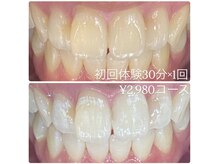 ホワイトニングルーム 横浜店(Whitening Room)/ホワイトニング/横浜