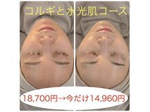 アロンジェファム(allonge femme)