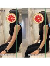 グレフル鍼灸接骨院 整体院 心斎橋/整体/肩こり/マッサージ/腰痛