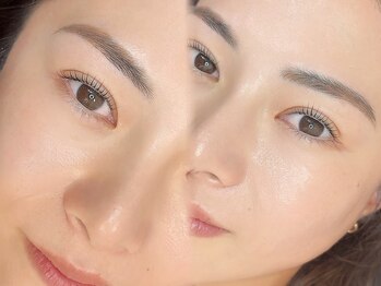 エミュ(emu)/トータルで魅せる即!美人セット