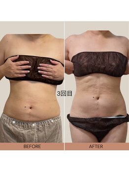 ママニエ(ma maniere)/お腹くびれ美人コース