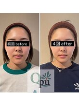 キュープ 鹿児島伊集院店(Qpu)/