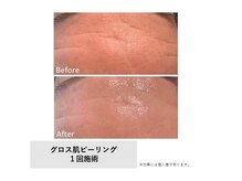 モイ(Moi’e)/シワ・小ジワ・たるみ