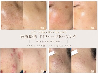 ジュパール(je pars)の写真