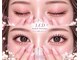 ピピプラス(pipi+)の写真