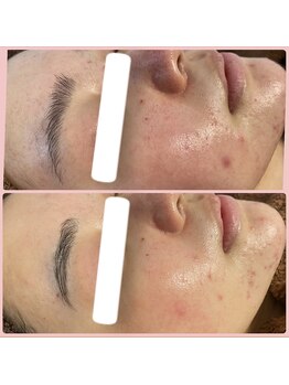 メリー 大和八木店(merry)/一度で感動のツルツル触感♪