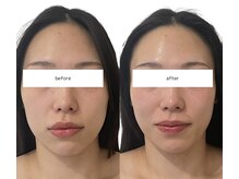 ソナ 大和西大寺院(SONA)/