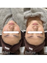 ラ フルール(La Fleur)/カーボキシートリートメント