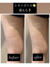 チャルム(CAL'ME)/レモンボトル・もも裏　