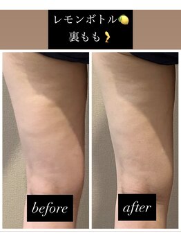 チャルム(CAL'ME)/レモンボトル・もも裏