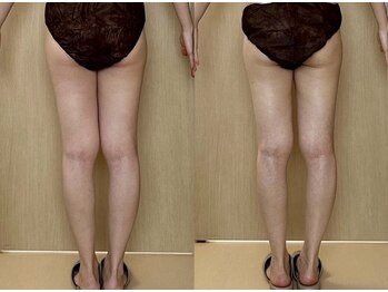 ココア(CoCoa)/活性リンパ洗浄