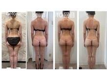 ロココ 横浜店(Rococo)/全身矯正＋バストアップコース