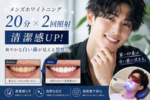 ホワイトニングショップ 日進店