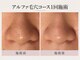 トリプルサンショップ 京都店の写真/【京都/四条】大人の毛穴悩みに。黒ずみ・角栓・ザラつきを丁寧に洗浄し、つるんとなめらかな素肌へ