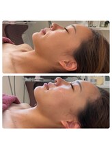 シュシュ(Chou chou)/泉佐野エステ　小顔　セルマン