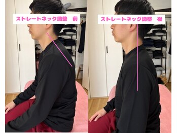 ボディステップ(BODY STEP)/姿勢S字調整