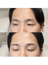 アイリー(IRIE)/【MENS】ハリウッドブロウリフト