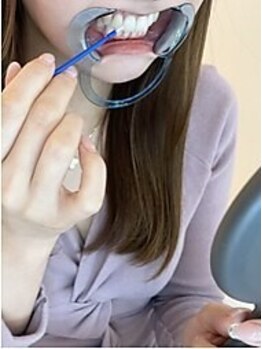 エクシアホワイトニング 西尾店の写真/最新機器使用で当店人気☆蓄積された汚れはコスパ抜群のエクシアで白い歯に！ブライダル前にもオススメ◎