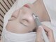 リム(LIMU)の写真/【ほうれい線・たるみケアでお悩みの大人女性は必見】驚きの効果実感！透明感あふれるハリツヤ美肌へ♪