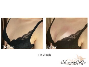 シャルムココ 蔵前店(CharmeCoCo)/ お客様Before→After