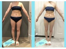 千歳の女神 岡崎店/【施術風景】Before/After