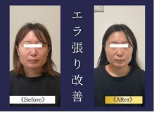 エレミュー 烏丸(Elemue.)/遺伝だからとあきらめないで。