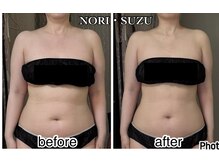 ノリスズ(NORI SUZU)/1度で《痩身×姿勢×バストUP》