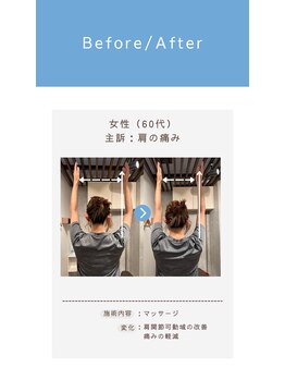 アーク コンディショニングラボラトリー ジユウガオカ(ARK Conditioning Laboratory)/肩関節可動域の改善