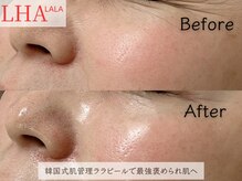 ビューティー サロン アイビー(Ivy)