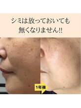 パルサロン(palsalon.)/パルサロン　シミケア